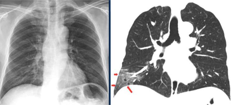 https://cdn.ncbi.nlm.nih.gov/pmc/blobs/2f73/7968176/70cbae80868e/gr2_lrg.jpg