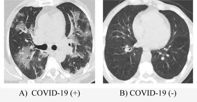 https://cdn.ncbi.nlm.nih.gov/pmc/blobs/2f73/7968176/ded258ce9de5/gr9_lrg.jpg