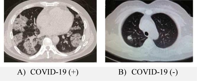 https://cdn.ncbi.nlm.nih.gov/pmc/blobs/2f73/7968176/f38bb888ce71/gr7_lrg.jpg