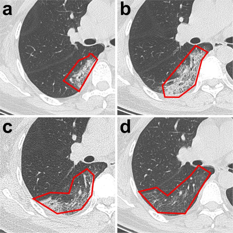 https://cdn.ncbi.nlm.nih.gov/pmc/blobs/2f73/7968176/f9d6b80ca28f/gr4_lrg.jpg