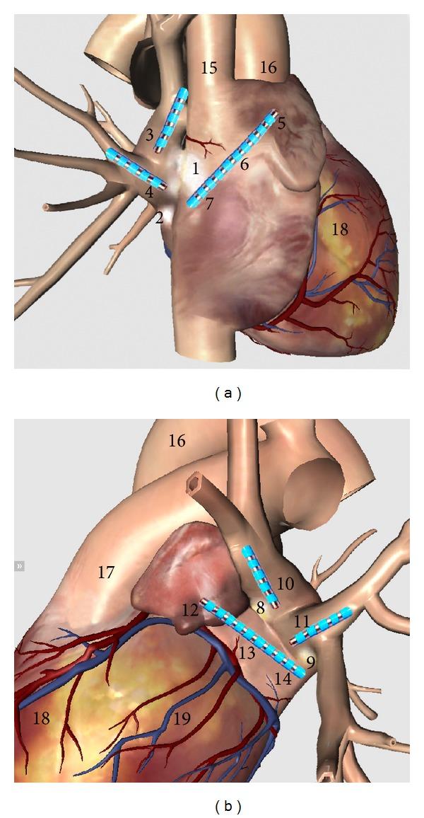 https://cdn.ncbi.nlm.nih.gov/pmc/blobs/2f76/3705940/11616310b833/TSWJ2013-781084.001.jpg