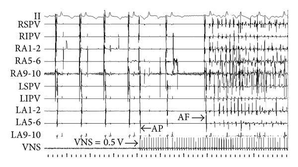 https://cdn.ncbi.nlm.nih.gov/pmc/blobs/2f76/3705940/319734ccdbcc/TSWJ2013-781084.007.jpg