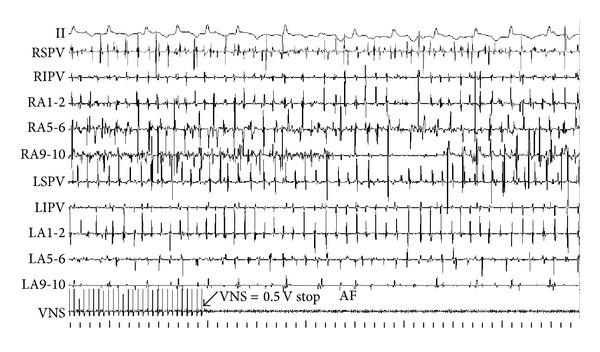 https://cdn.ncbi.nlm.nih.gov/pmc/blobs/2f76/3705940/b887f1702673/TSWJ2013-781084.008.jpg
