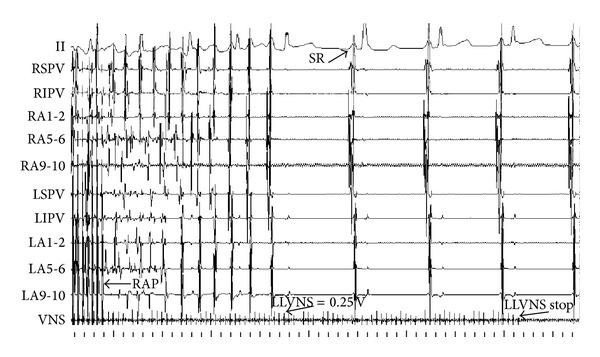 https://cdn.ncbi.nlm.nih.gov/pmc/blobs/2f76/3705940/cac69a7ae071/TSWJ2013-781084.009.jpg