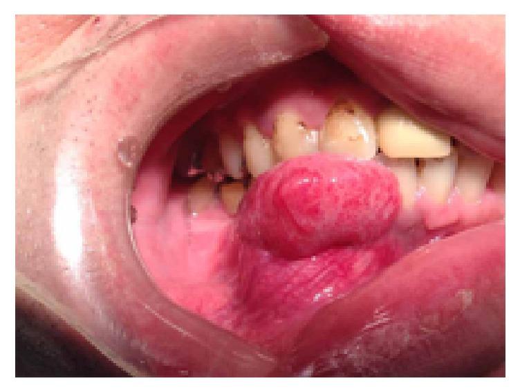 https://cdn.ncbi.nlm.nih.gov/pmc/blobs/2f7d/5443997/9aeda9b5b211/CRIPA2017-7031414.001.jpg