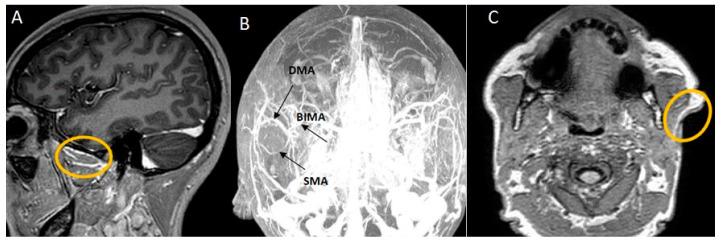 https://cdn.ncbi.nlm.nih.gov/pmc/blobs/2f7e/11050910/2db532977f77/jpm-14-00343-g004.jpg