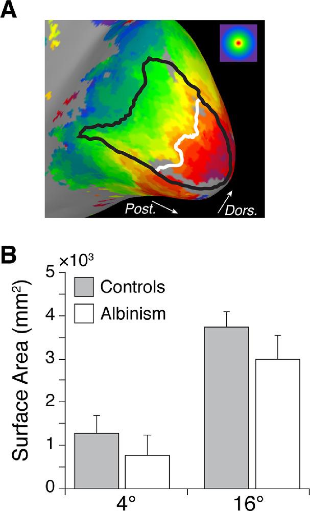 https://cdn.ncbi.nlm.nih.gov/pmc/blobs/2f81/7416892/649188785c23/jovi-20-6-10-f003.jpg
