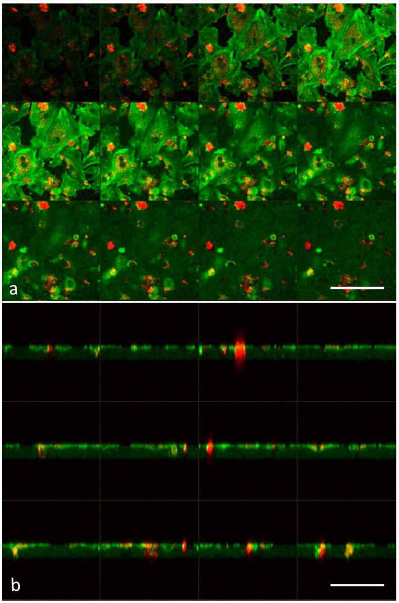 https://cdn.ncbi.nlm.nih.gov/pmc/blobs/2f85/10294930/94fd164bae12/biomedicines-11-01544-g004.jpg