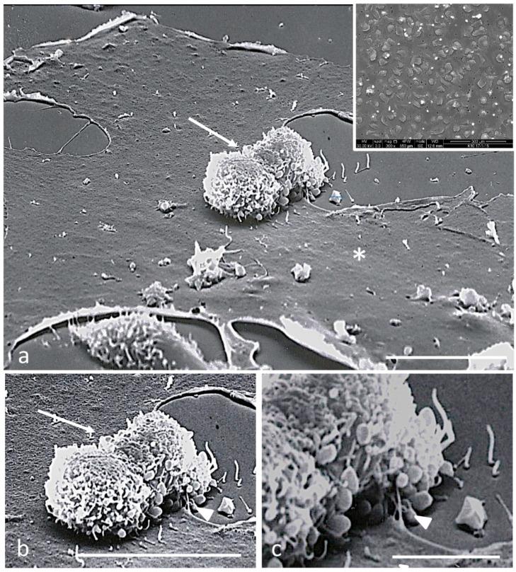 https://cdn.ncbi.nlm.nih.gov/pmc/blobs/2f85/10294930/a9ecde4c419b/biomedicines-11-01544-g006.jpg