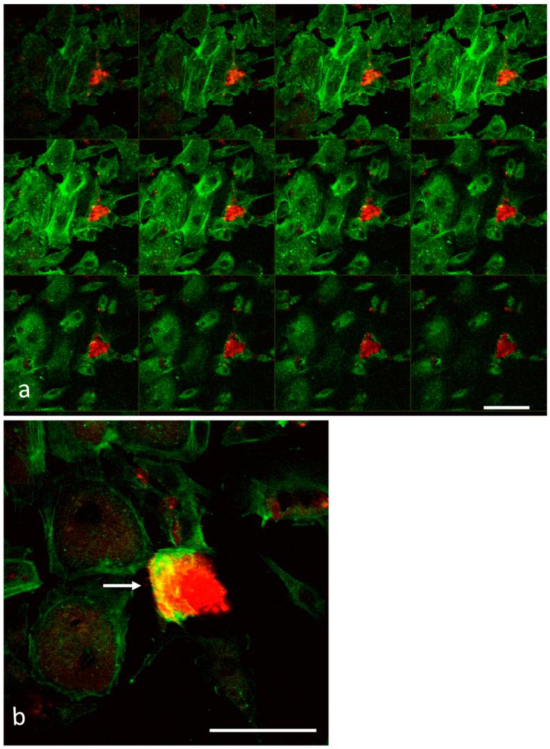 https://cdn.ncbi.nlm.nih.gov/pmc/blobs/2f85/10294930/efd6091594b9/biomedicines-11-01544-g005.jpg