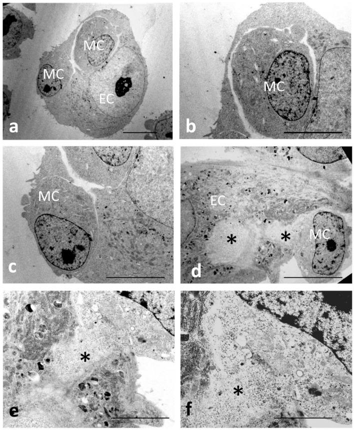 https://cdn.ncbi.nlm.nih.gov/pmc/blobs/2f85/10294930/f39ce227c07e/biomedicines-11-01544-g012.jpg