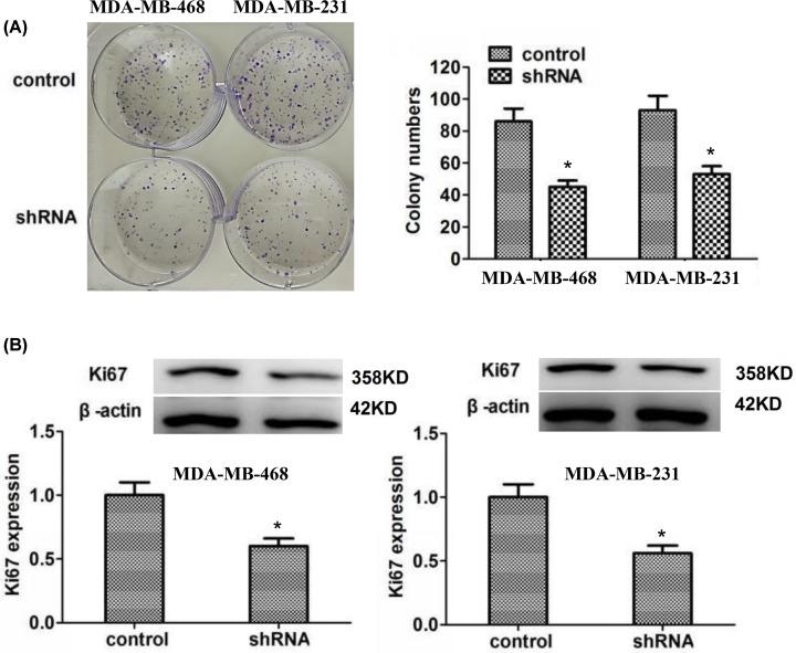 https://cdn.ncbi.nlm.nih.gov/pmc/blobs/2f8a/7846963/5103e1c13281/bsr-41-bsr20203874-g4.jpg
