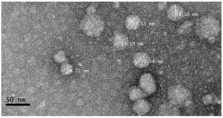 https://cdn.ncbi.nlm.nih.gov/pmc/blobs/2f90/7249151/88093ea68e1b/molecules-25-02244-g006.jpg