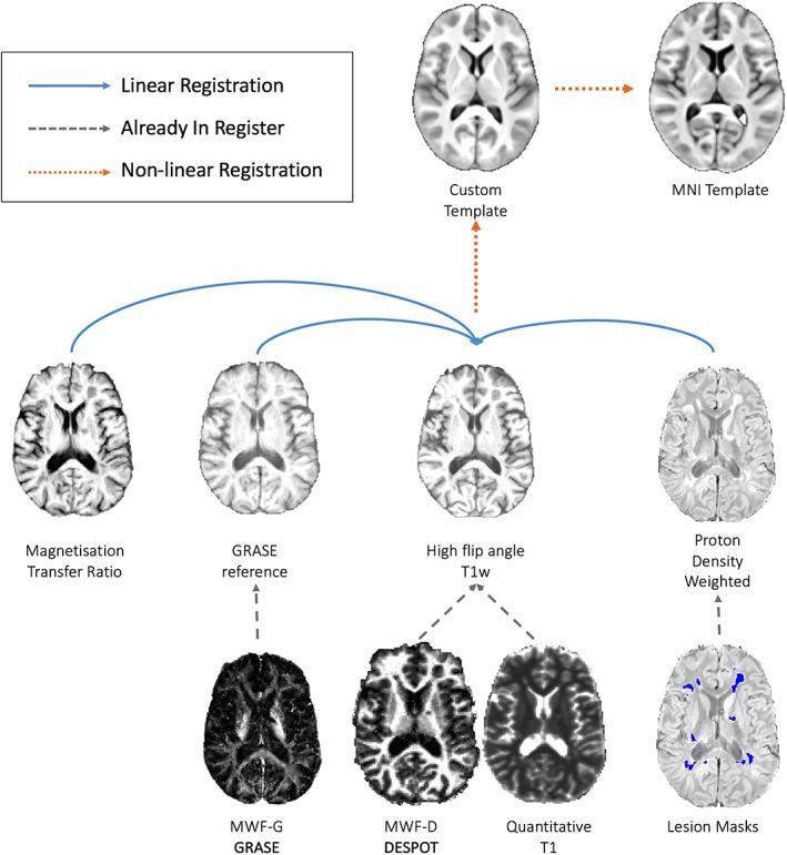 https://cdn.ncbi.nlm.nih.gov/pmc/blobs/2f94/6865427/1c125c155200/HBM-40-2104-g001.jpg