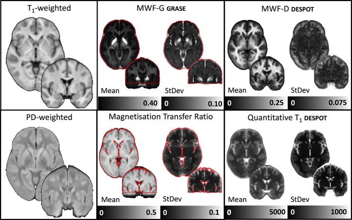 https://cdn.ncbi.nlm.nih.gov/pmc/blobs/2f94/6865427/e815c6655b99/HBM-40-2104-g002.jpg