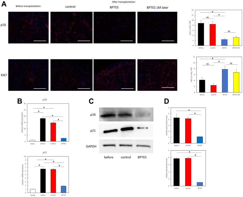 https://cdn.ncbi.nlm.nih.gov/pmc/blobs/2f9e/9740363/2a4abfe3391d/aging-14-204391-g004.jpg