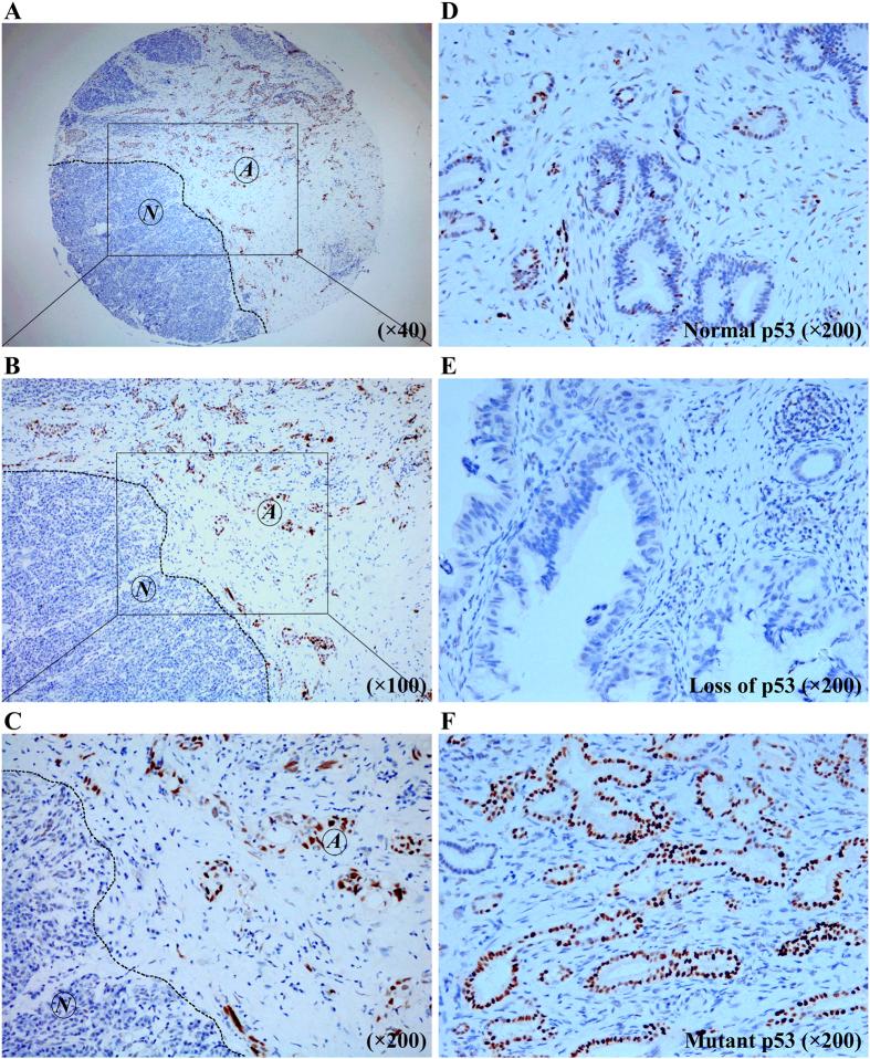 https://cdn.ncbi.nlm.nih.gov/pmc/blobs/2fa1/4709775/c5a8814c979f/srep19222-f1.jpg