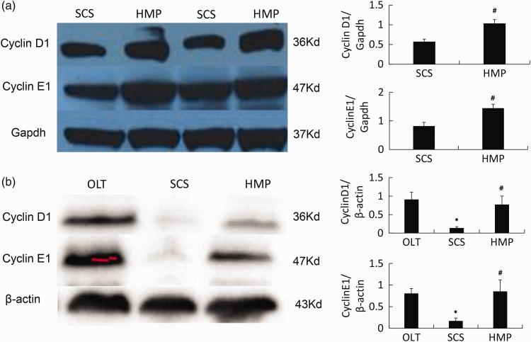 https://cdn.ncbi.nlm.nih.gov/pmc/blobs/2fab/6384453/829716af264a/10.1177_0300060518787726-fig6.jpg