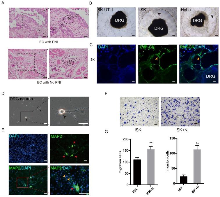 https://cdn.ncbi.nlm.nih.gov/pmc/blobs/2fab/7066017/777d9ad758e2/jcav11p2518g001.jpg