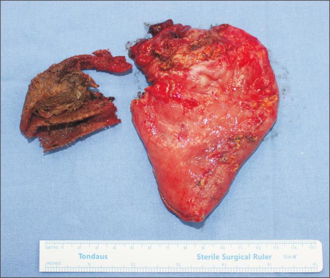https://cdn.ncbi.nlm.nih.gov/pmc/blobs/2fad/11187609/76b9bd24b025/jmis-27-2-109-f5.jpg