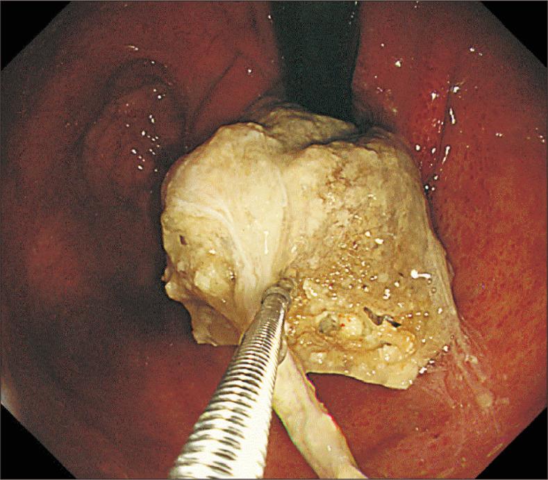 https://cdn.ncbi.nlm.nih.gov/pmc/blobs/2fad/11187609/7b6f4644c8b3/jmis-27-2-109-f3.jpg