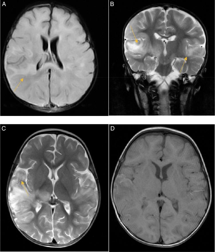 https://cdn.ncbi.nlm.nih.gov/pmc/blobs/2fb6/11152819/85ce98408668/ms9-86-3674-g001.jpg