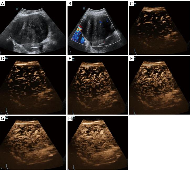 https://cdn.ncbi.nlm.nih.gov/pmc/blobs/2fba/12084734/6a9fae995bad/qims-15-05-3875-f4.jpg