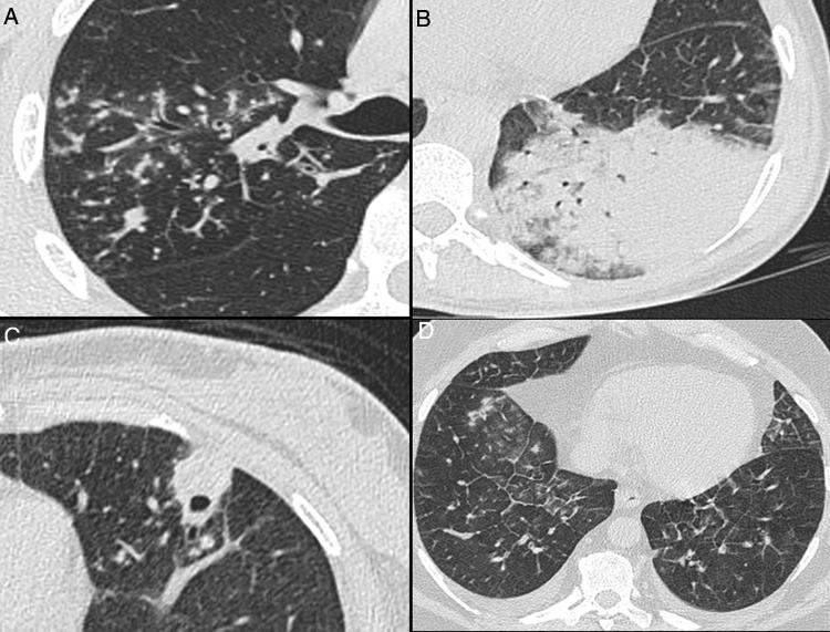https://cdn.ncbi.nlm.nih.gov/pmc/blobs/2fbd/9392104/1a880655d169/gr4.jpg