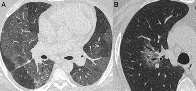 https://cdn.ncbi.nlm.nih.gov/pmc/blobs/2fbd/9392104/4945bb574166/gr5.jpg
