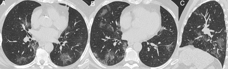 https://cdn.ncbi.nlm.nih.gov/pmc/blobs/2fbd/9392104/c7ec5dabe8aa/gr6.jpg