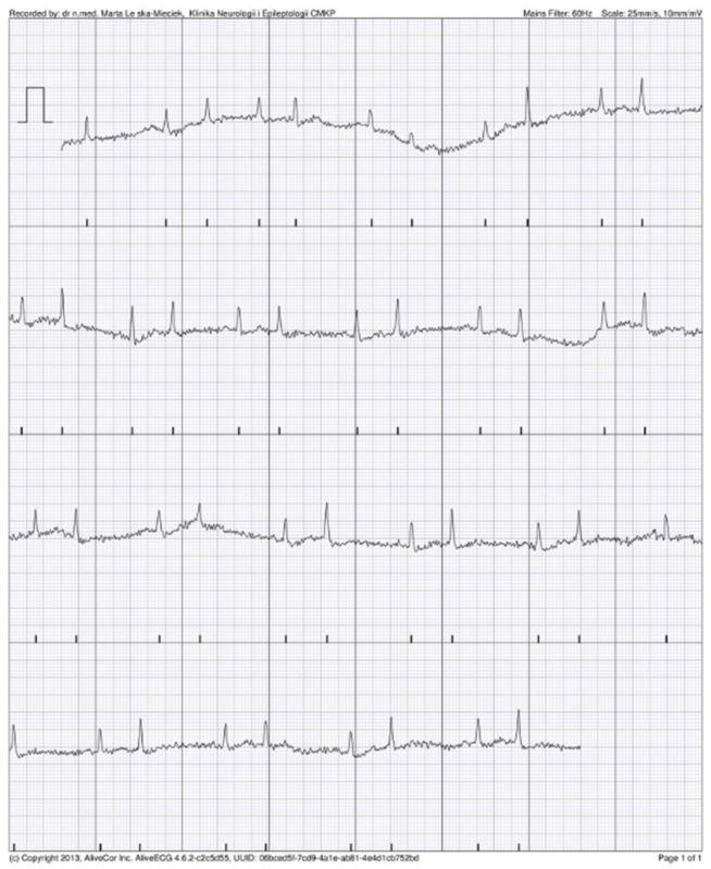 https://cdn.ncbi.nlm.nih.gov/pmc/blobs/2fc4/8836576/f089cf32aa43/jcm-11-00665-g005.jpg