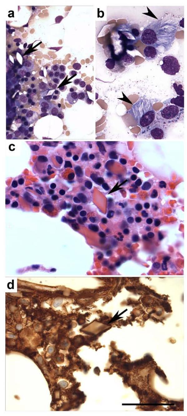 https://cdn.ncbi.nlm.nih.gov/pmc/blobs/2fc9/2823683/a5b607559c17/1746-1596-5-6-1.jpg