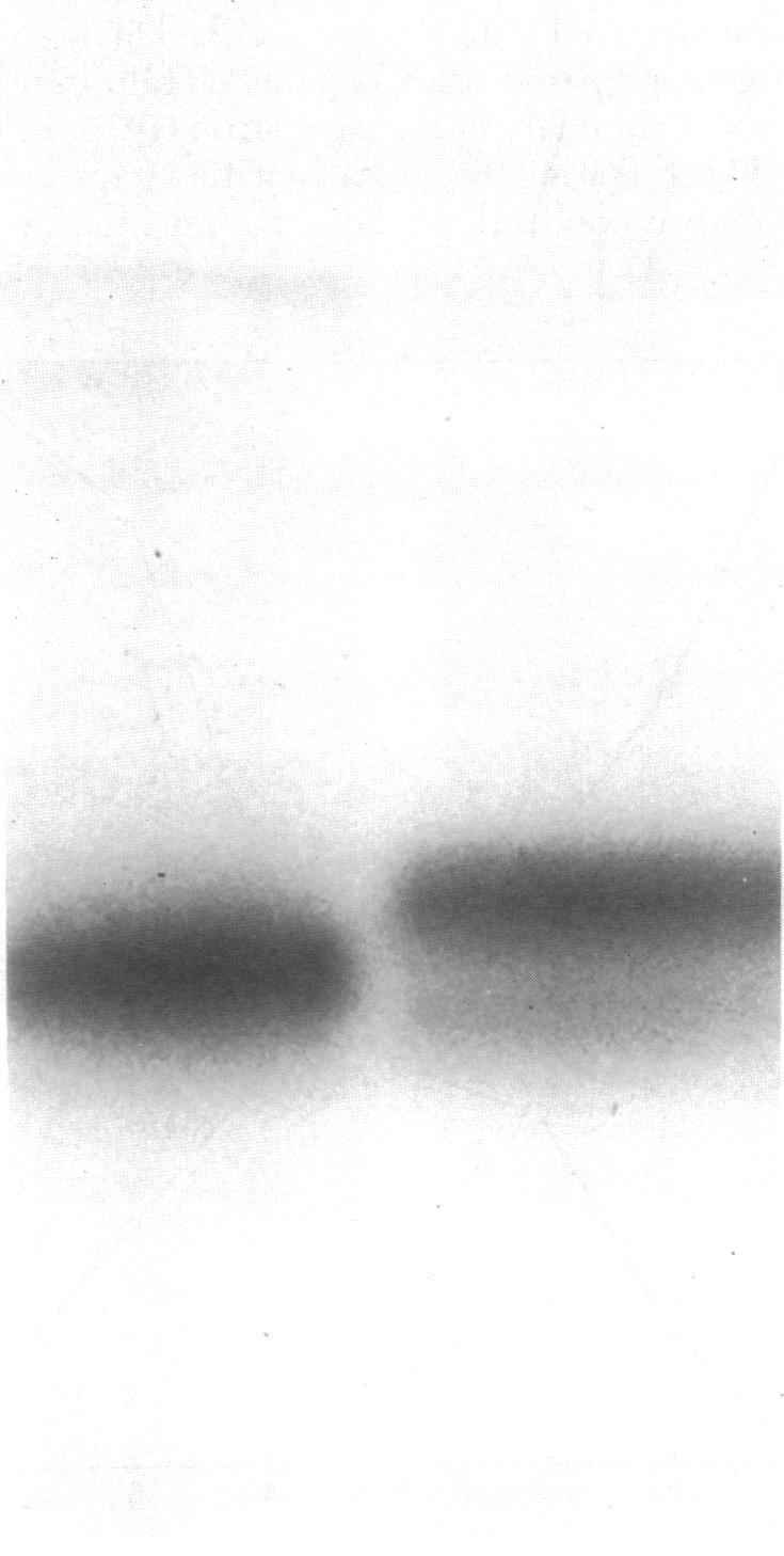 https://cdn.ncbi.nlm.nih.gov/pmc/blobs/2fc9/392767/f3fdb348d978/pnas00019-0320-b.jpg