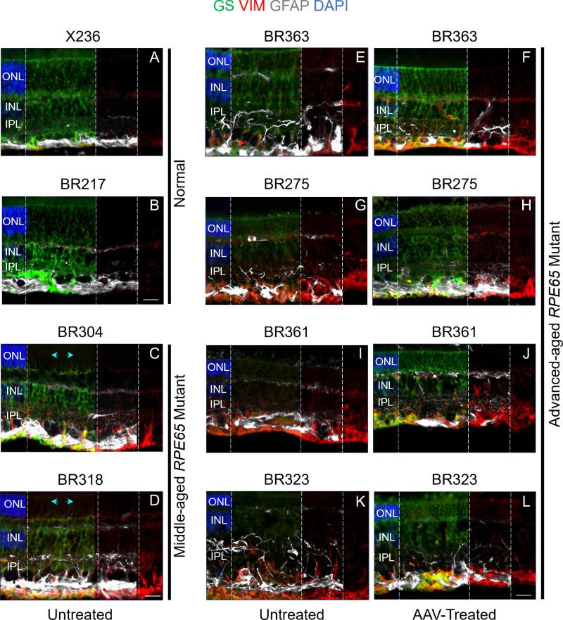 https://cdn.ncbi.nlm.nih.gov/pmc/blobs/2fca/11472885/2aea979e33cd/iovs-65-12-18-f003.jpg