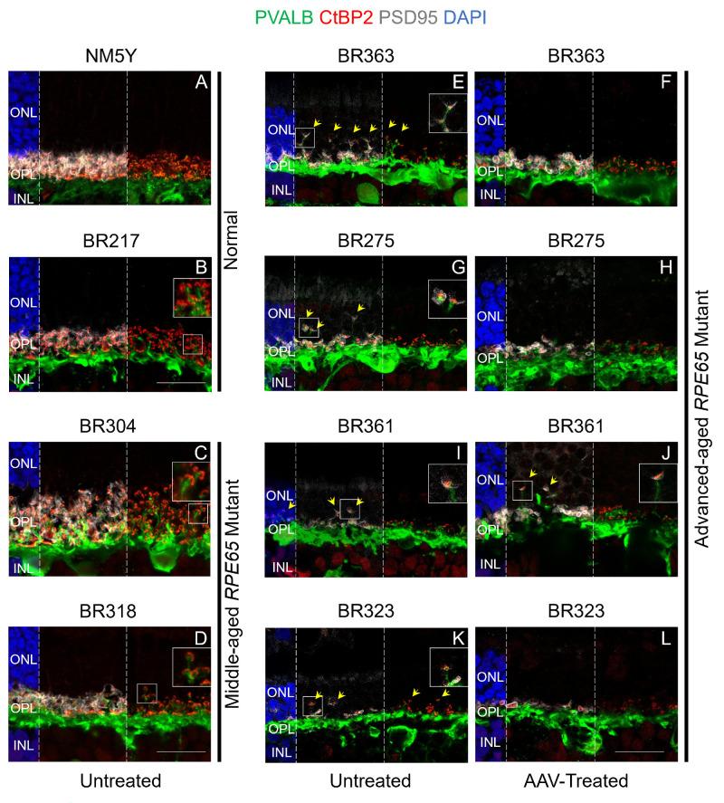 https://cdn.ncbi.nlm.nih.gov/pmc/blobs/2fca/11472885/f377f3fa1e72/iovs-65-12-18-f004.jpg
