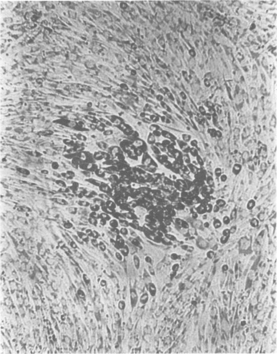https://cdn.ncbi.nlm.nih.gov/pmc/blobs/2fd3/274391/6a46298d92f7/jcm00216-0083-a.jpg