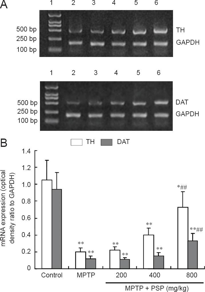 https://cdn.ncbi.nlm.nih.gov/pmc/blobs/2fd6/4392681/b291f827c9e4/NRR-10-308-g003.jpg