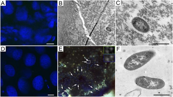https://cdn.ncbi.nlm.nih.gov/pmc/blobs/2fd6/5641371/cad3fffdac07/fmicb-08-01942-g003.jpg