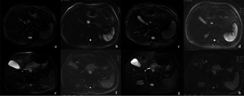 https://cdn.ncbi.nlm.nih.gov/pmc/blobs/2fd8/9942330/7639dfaf9f6f/40644_2023_529_Fig2_HTML.jpg