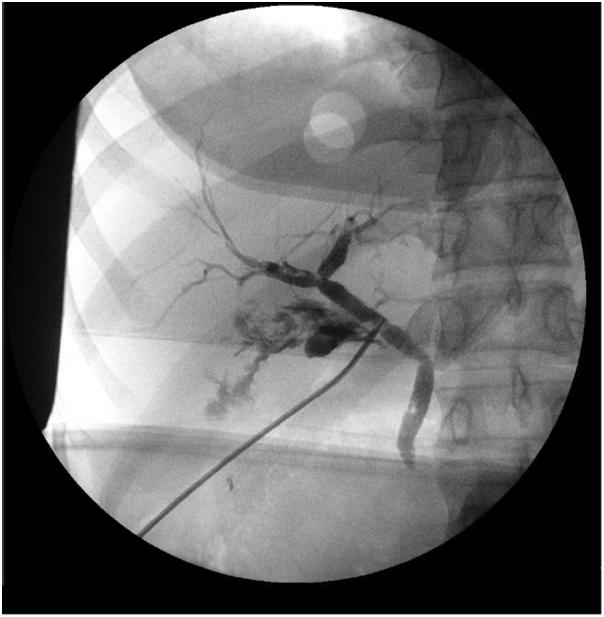 https://cdn.ncbi.nlm.nih.gov/pmc/blobs/2fdb/6407078/22abab3969ae/gr2.jpg