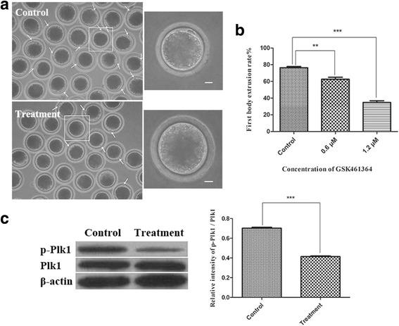 https://cdn.ncbi.nlm.nih.gov/pmc/blobs/2fe2/5575893/d1edd4a7e6fb/12958_2017_289_Fig3_HTML.jpg