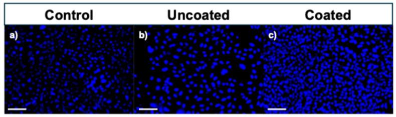 https://cdn.ncbi.nlm.nih.gov/pmc/blobs/2fe9/12157572/e45cdc95d474/polymers-17-01510-g012.jpg