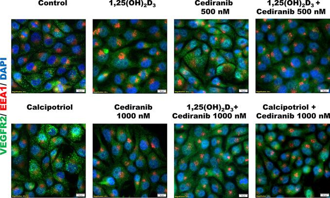 https://cdn.ncbi.nlm.nih.gov/pmc/blobs/2fea/8740239/94913e471460/fonc-11-763895-g007.jpg