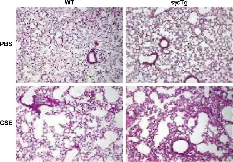 https://cdn.ncbi.nlm.nih.gov/pmc/blobs/2feb/5352154/947111557c51/copd-12-817Fig5.jpg