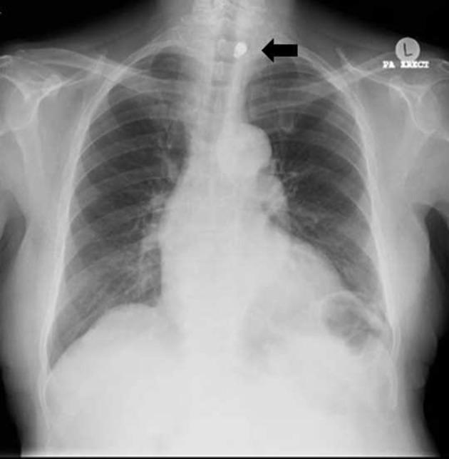 https://cdn.ncbi.nlm.nih.gov/pmc/blobs/2fef/6159178/9dce9468c311/bjrcr.20170050.g001.jpg