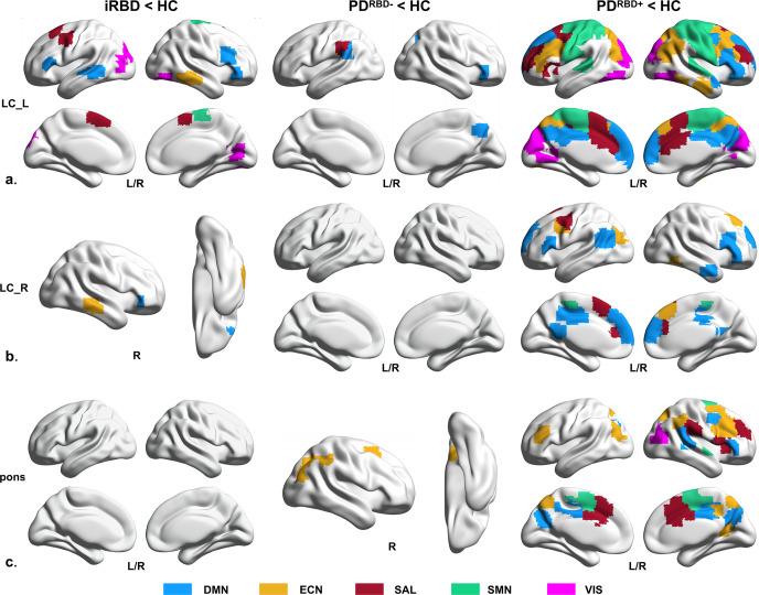 https://cdn.ncbi.nlm.nih.gov/pmc/blobs/2ff4/10229645/9f8b94483233/41531_2023_532_Fig1_HTML.jpg