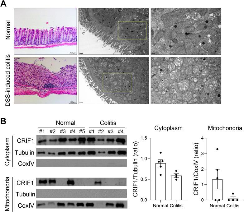 https://cdn.ncbi.nlm.nih.gov/pmc/blobs/2ffa/12350146/2d7bee2d624e/fimmu-16-1618012-g005.jpg