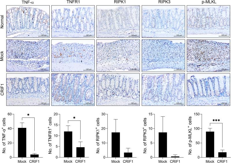 https://cdn.ncbi.nlm.nih.gov/pmc/blobs/2ffa/12350146/8307d4329192/fimmu-16-1618012-g003.jpg