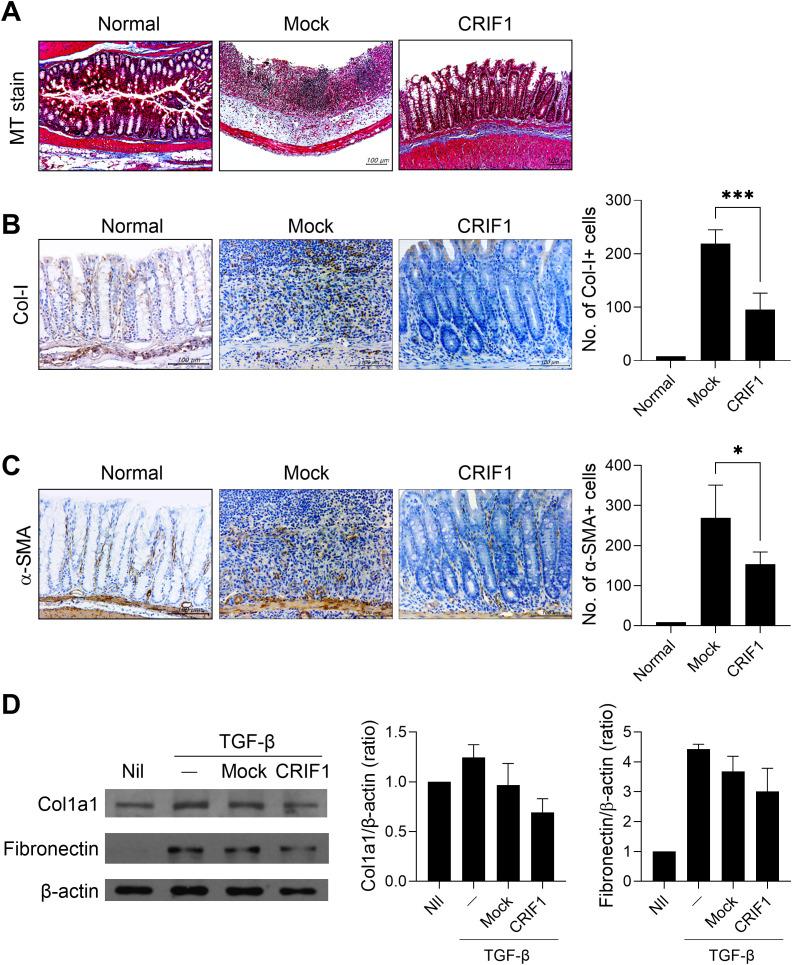 https://cdn.ncbi.nlm.nih.gov/pmc/blobs/2ffa/12350146/d785ae3973fc/fimmu-16-1618012-g004.jpg
