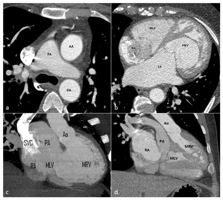 https://cdn.ncbi.nlm.nih.gov/pmc/blobs/3000/11393892/164fdfe85c5b/diagnostics-14-01851-g002.jpg